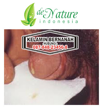 Keluar Cairan Putih Dari Saluran Testis