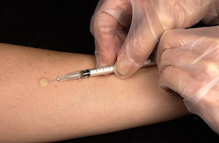 Intradermal injection is injection into the dermis of the skin. It has some advantages as well as disadvantages