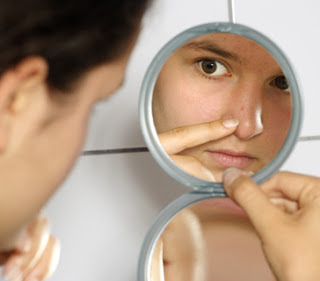 Untuk perawatan wajah yang berkomedo ada 4 Cara Alami Menghilangkan 