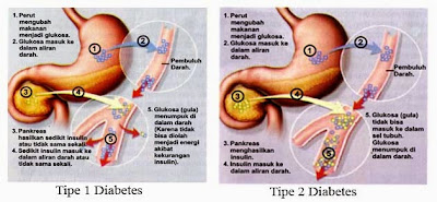 Diabetes dengan Daun Afrika