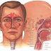 Cara Menyembuhkan Sinusitis Secara Alami