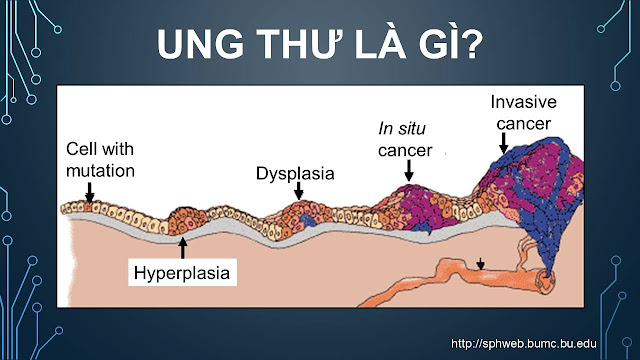 Ung thư: suy nghĩ như một bác sĩ và tìm tòi như một nhà nghiên cứu