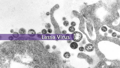 Virus Lassa