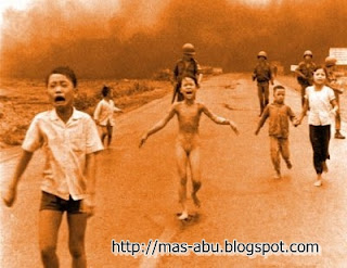 Foto-foto Bersejarah di Dunia - Korban Napalm