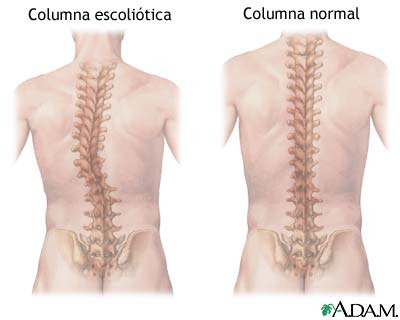 COLUMNA VERTEBRAL Y DEPORTE Introducci n La totalidad de los deportes