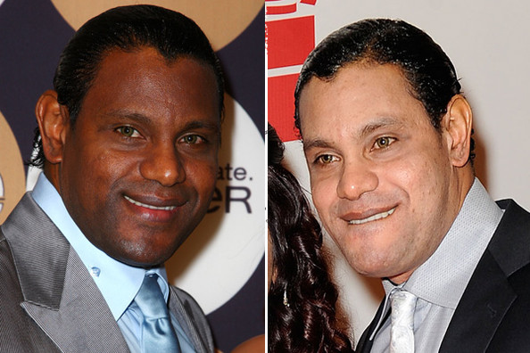 Sammy Sosa Before and After