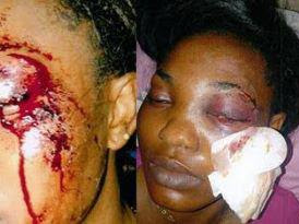 Shocking As Man Stab Wife In The Eye!!