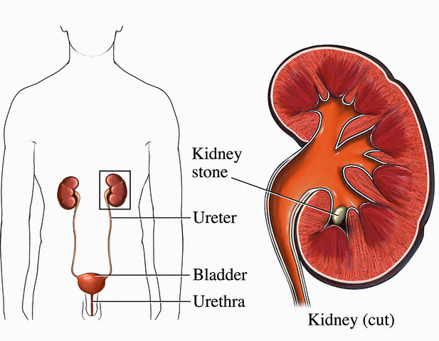 urine such as uric acid, 2011