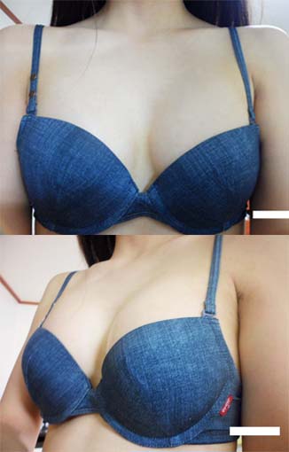 짱이뻐! - Lovely Breast With Korean Celebrities Breast Plastic Surgery