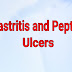 Gastritis And Peptic Ulcers