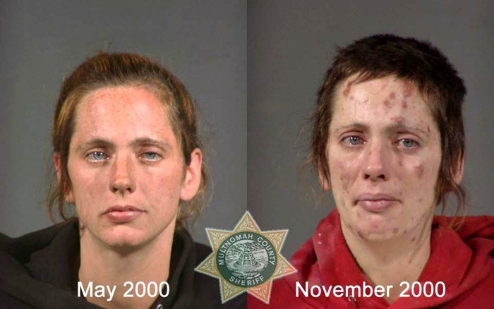 drug-abuse10