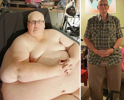 Shocking Before And After Weight Loss Transformations That Will Inspire You Forever