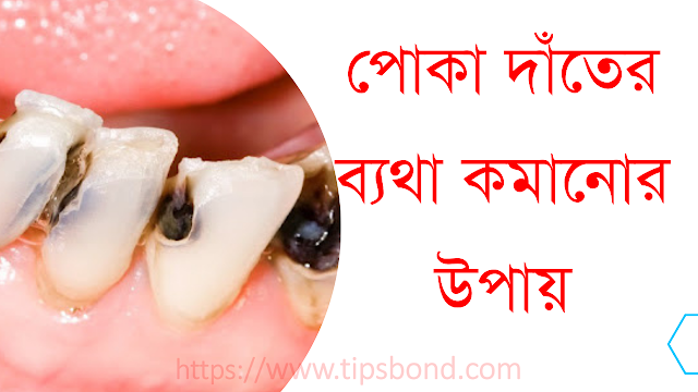 পোকা দাঁতের ব্যথা কমানোর উপায়