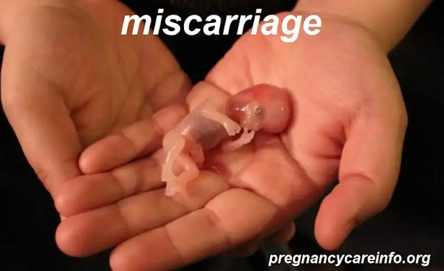 Miscarriage Signs and Symptoms