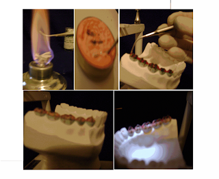 Imagens de escultura dental em cera passo a passo