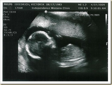 ultrasound_1