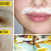 Remedies Amazing Methods To Remove Your Upper Lips Hair Permanently!!!