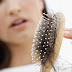 علاج ضعف الشعر