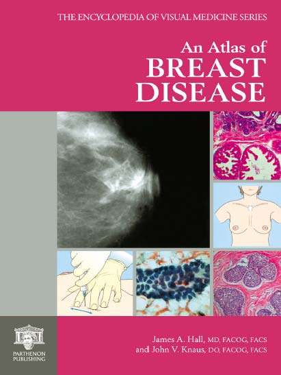 An Atlas of Breast Disease - Free Ebook - 1001 Tutorial & Free Download