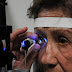 Glaucoma, primera causa de ceguera irreversible a nivel mundial