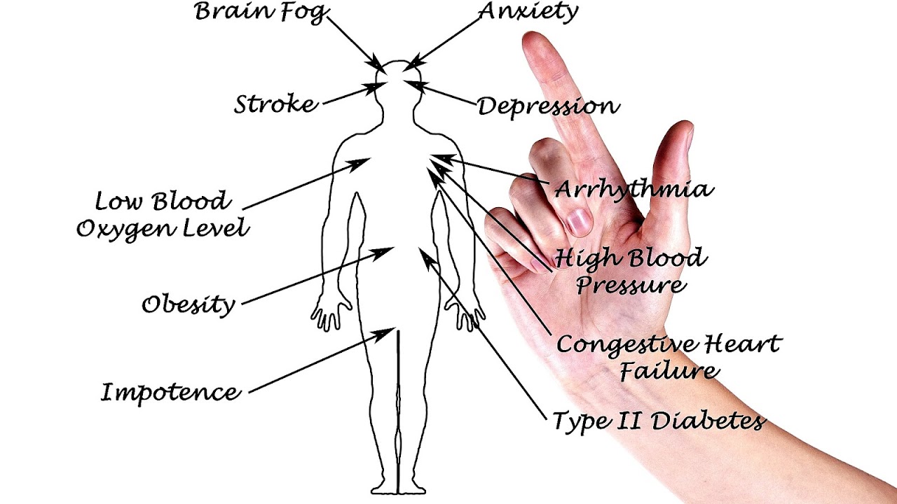 Sleep Apnea Stats