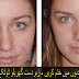 How Get Rid Of Acne And Its Spots At Home - Complete Remedy In Urdu And English