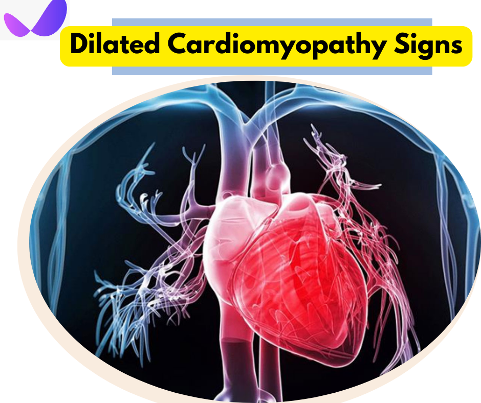 Dilated Cardiomyopathy Signs