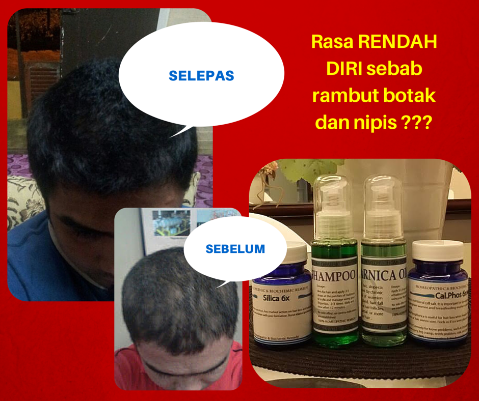 PRODUK KESIHATAN DALAMAN & LUARAN: Testimoni Set Rambut 