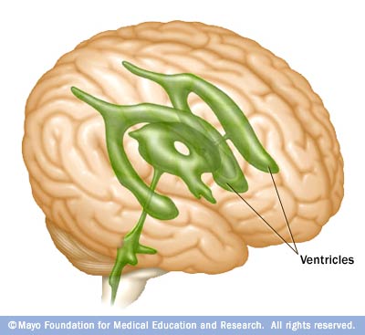 Brain Ventricles