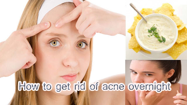 Natural Ways To Get Rid Of Pimples Overnight Fast