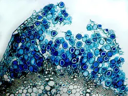 Transverse section of stem of coriander passing through gall showing chlamydospores between epidermis and vascular region