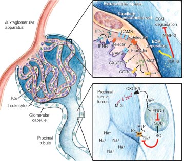 nursing care plan for glomerulonephritis nursing diagnosis ineffective 