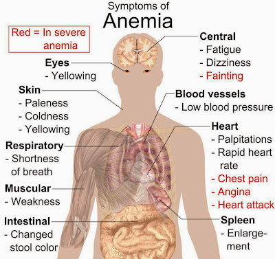 Tanda dan Gejala  Anemia