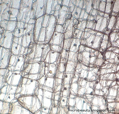 Onion cells near the skin area. Two layers are visible. Magnification - 100 Times.