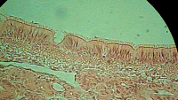 Real epithelial-cells