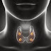 Cancer de la thyroïde - Causes et symptômes de cancer de la thyroïde