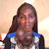 Tragic End: Woman who chose money over free surgery for goiter passes away