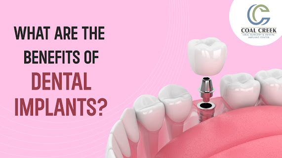 coal-creek-dental-implant