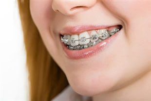 Quels risques avec l'orthodontie?