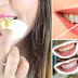 DIY - 10 Home Remedies To Whiten Teeth