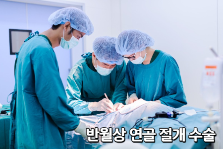 반월상 연골 봉합 수술 사진