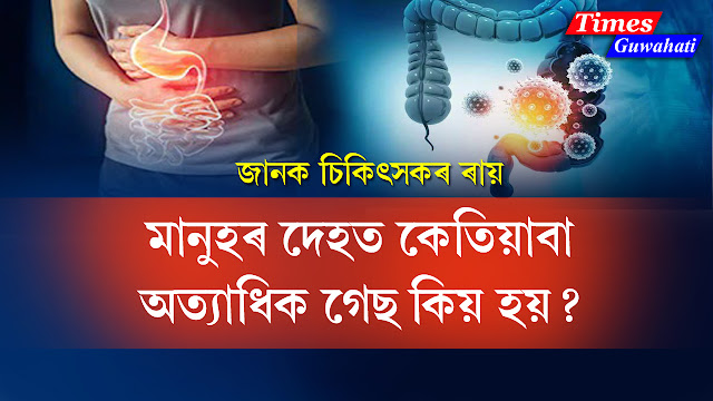 why some people develop excessive stomach gas and treatment of gas know from doctor rudrajit pal