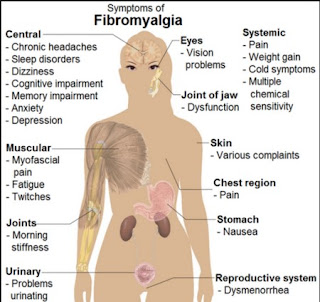 Pengertian penyakti Fibromyalgia, Penyebab, Gejala dan Pengobatan