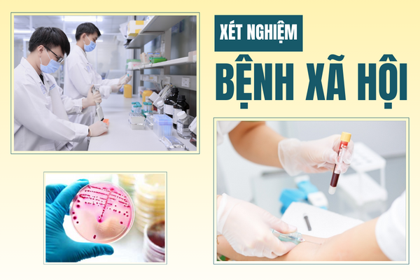 Khi nào cần xét nghiệm bệnh xã hội