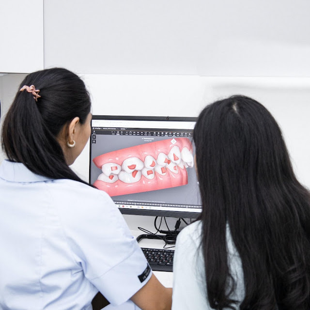 La importancia de las guías quirúrgicas dentales