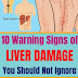 10 Warning Signs of Liver Damage You Should Not Ignore