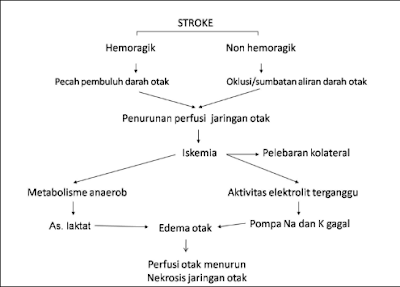 Laporan Pendahuluan Stroke Non Hemoragik Terbaru Nanda Nic Noc