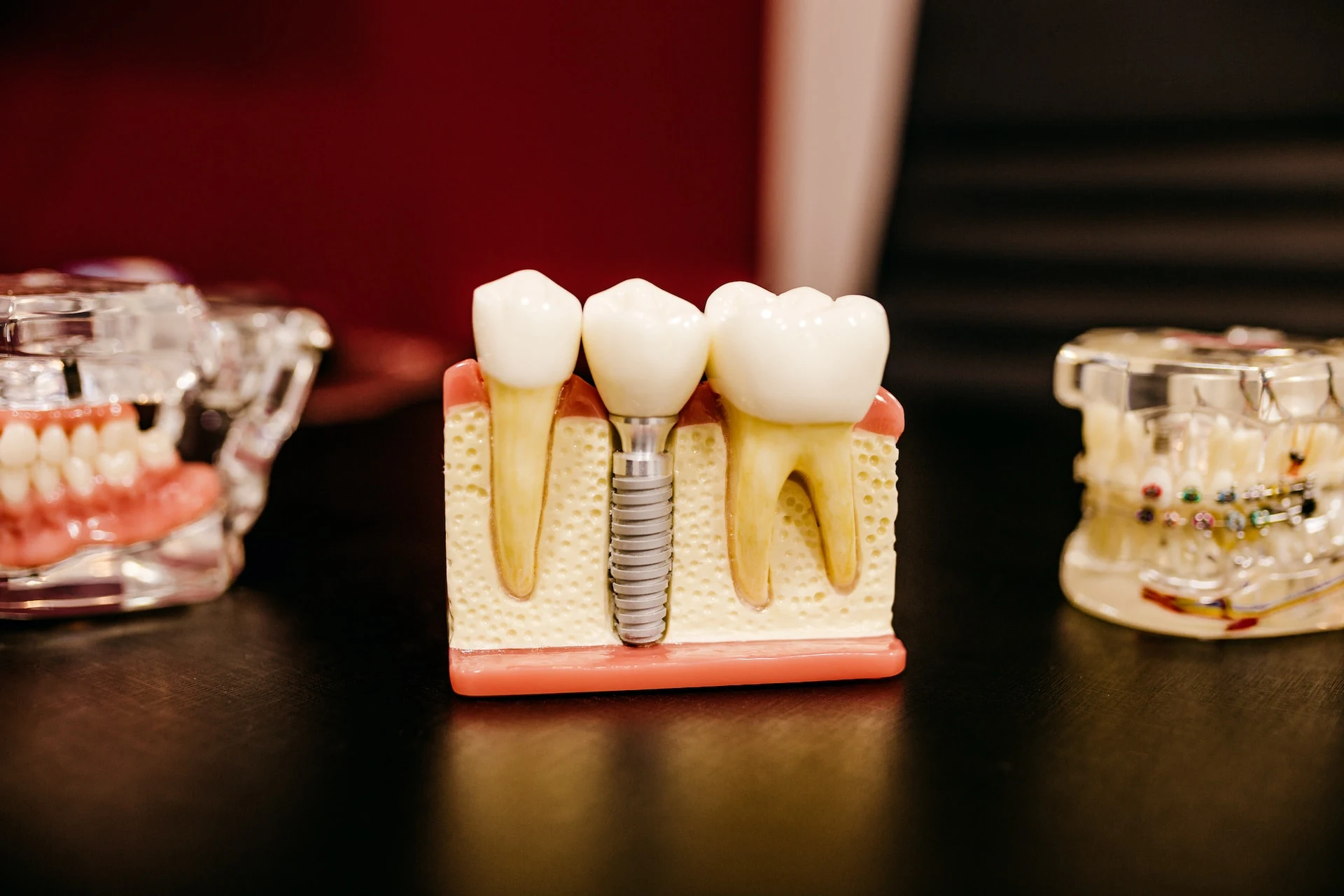 From Pain to Relief: The Importance of Root Canals and How They Preserve Dental Health