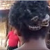 Jijik! Ular Bersarang Dalam Rambut Lelaki Ini Selama Hampir 3 Tahun ! Malang Tidak Berbau, Lihat KESAN Yang Berlaku ke Atas KULIT Kepalanya