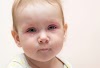 Red eyes in children: causes and treatments